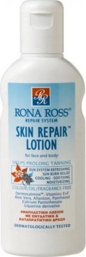 Λοσιόν After Sun Rona Ross για Πρόσωπο και Σώμα 160ml