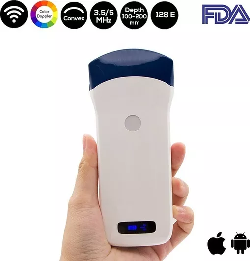 Ασύρματος Διαγνωστικός Υπέρηχος Sonostar 3.5-5.0MHz Convex Probe Color Doppler
