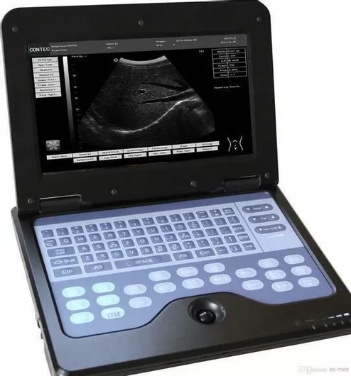 Φορητός Υπερηχογράφος Contec Convex 3.5MHz