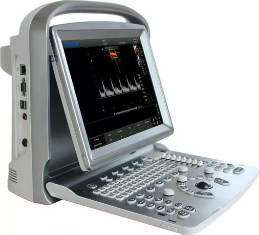 Chison ECO5 Doppler Ultrasound Machine